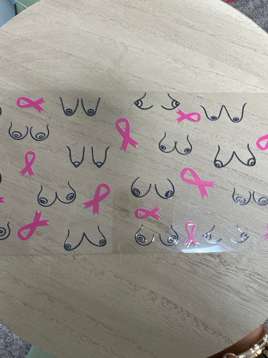 Breast Cancer